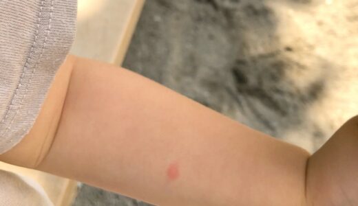 子どもの虫刺され対策｜虫よけの選び方とかき壊さないコツ【登録販売者がやさしく解説】
