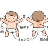 赤ちゃんのあせも