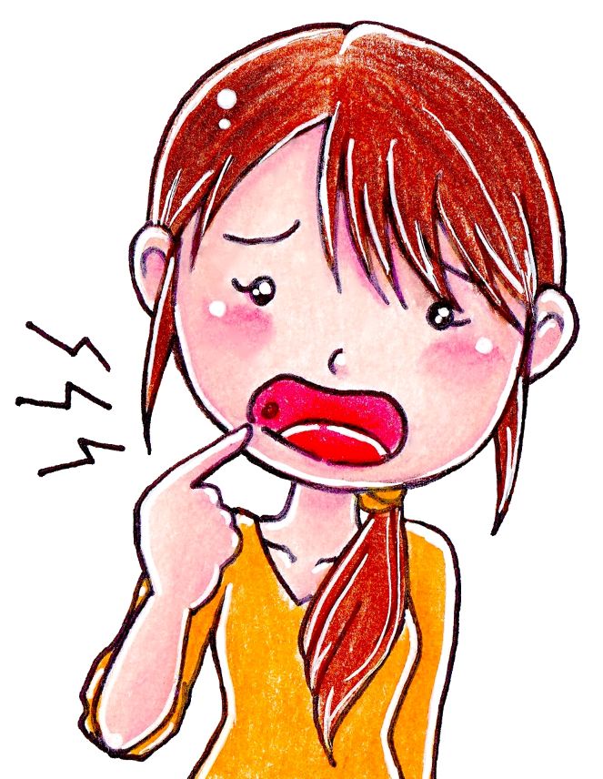 口内炎